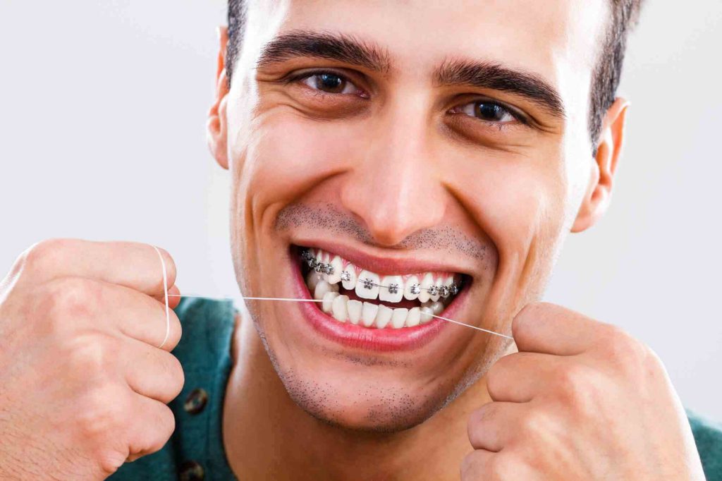 Aparat dentar la adulți