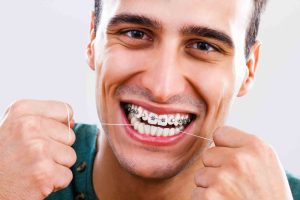 Aparat dentar la adulți